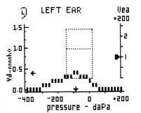 093670002MT2Chart[1]